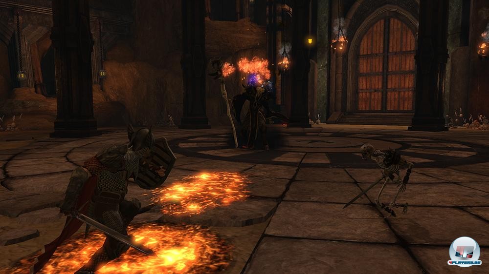 Wer pl&ouml;tzlich seiner Fertigkeiten beraubt wird, hat nichts zu lachen.