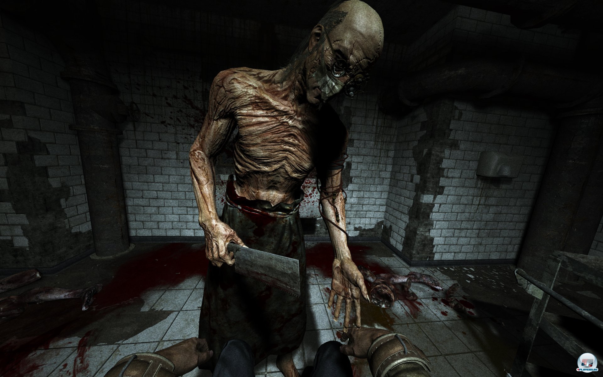 Die meisten der Patienten sind v&ouml;llig durchgeknallt.